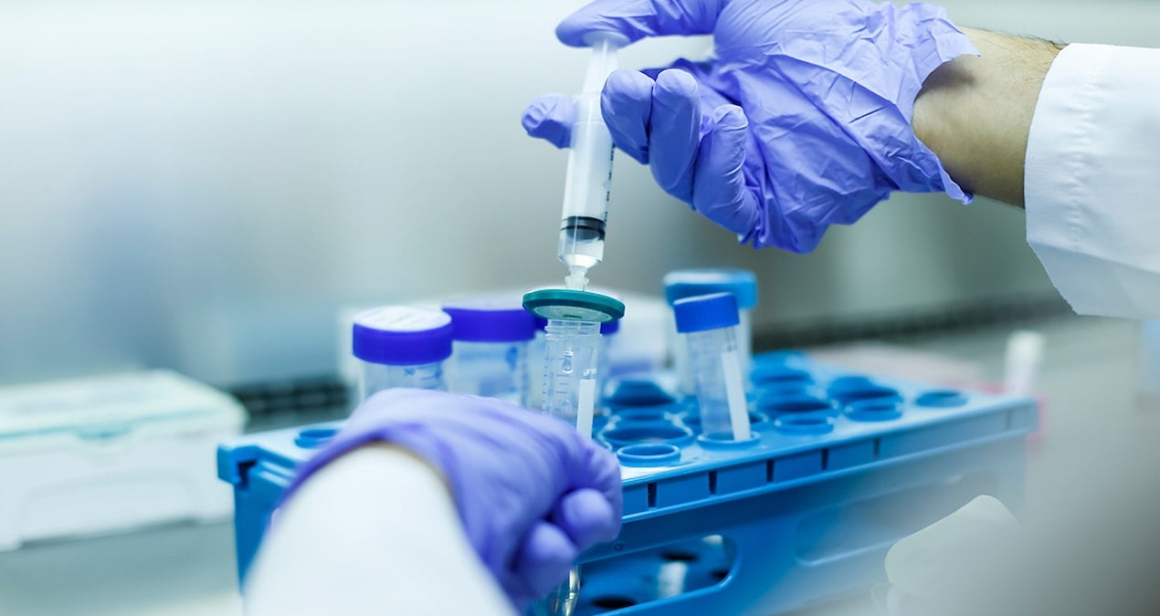 kanserden olumler 25 yil icinde yuzde 75 artabilir ZOx3zU9w