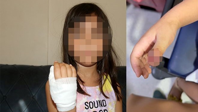 anaokulunda korkunc olay dort yasindaki cocugun parmagi koptu 8yHV2XOG