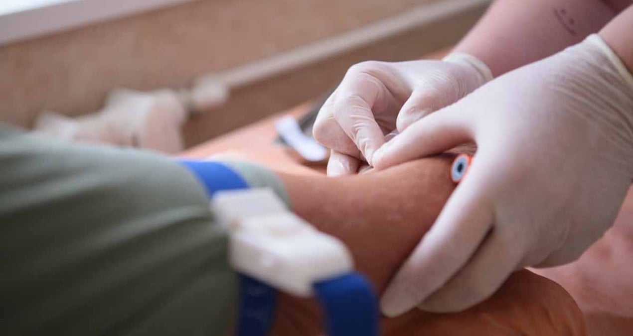 40 yasindan sonra herkesin yaptirmasi gereken 3 kan testi DrdMHyUn.jpg