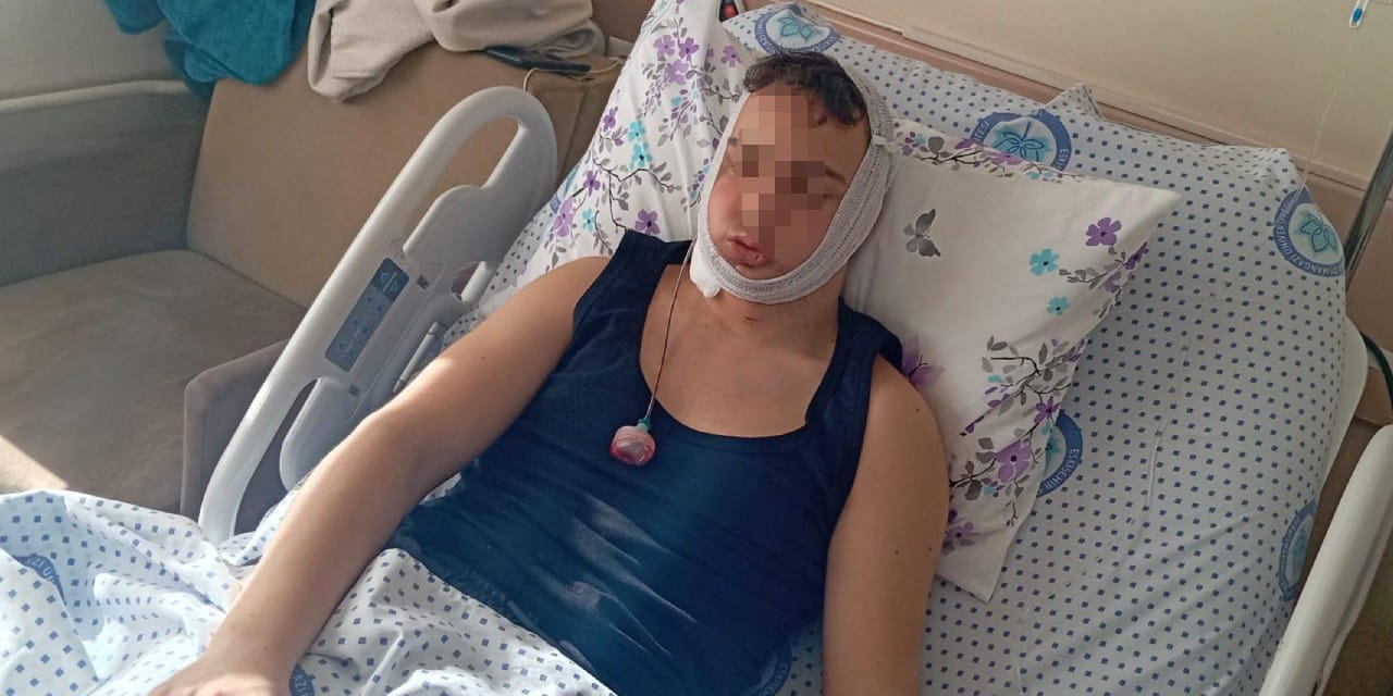 Liseli Gençteki Çene Kırılması Davasında 4 Sanık İlk Duruşmada Serbest Bırakıldı